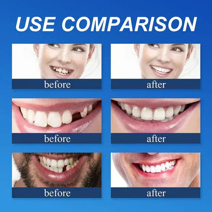 Ends Today: 70% OFF!  🏆2026 Bestselling Product🦷 Fit for a Fresh Smile, Say Goodbye to Wearing Discomfort!🌎